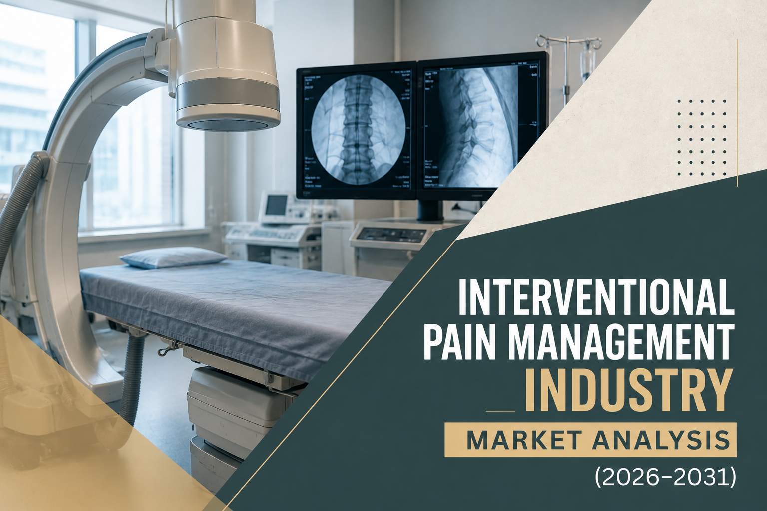 Interventional Pain Management Industry Market Research Report 2026&ndash;2031